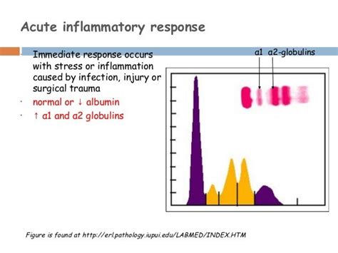 Serum Protein Electrophpresis