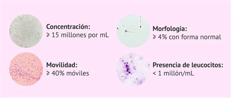 Análisis de los espermatozoides en el microscopio