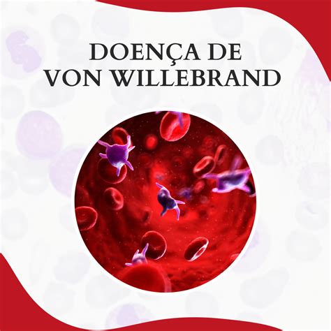 Doença de von Willebrand diagnóstico e cuidados Atlas Em Hematologia