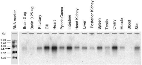 Tissue Distribution Of Rt Hsd Mrna Poly A Rna From Various Tissues