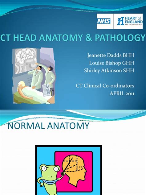 CT Head Anatomy & Pathology PDF | PDF