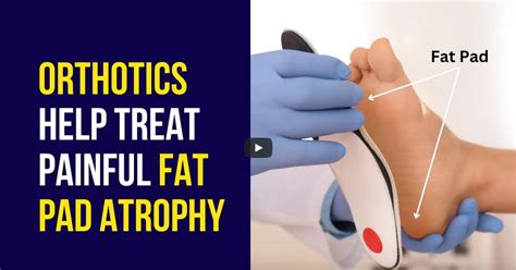 Orthotics Help in Fat Pad Atrophy Treatment – Ergonx