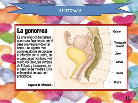 Enfermedades Asociadas Con El Sistema Reproductor Masculino Y Femenino