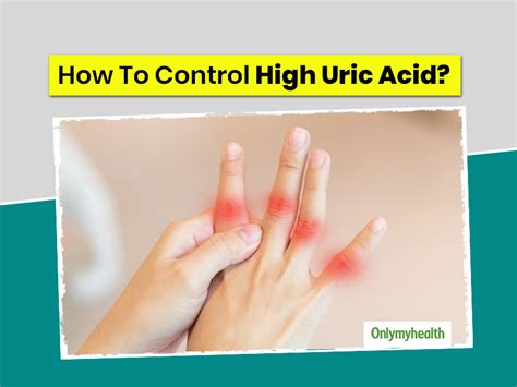 9 Ways To Naturally Reduce Uric Acid In The Body Onlymyhealth