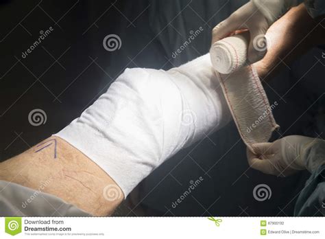 Knee Surgery Nurse Bandaging Stock Photo Image Of Joint Adult 87900192