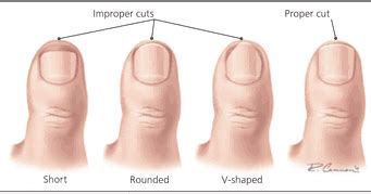 Step Soothers by Vita-Spa: Toenail Trimming Tips