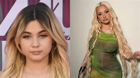 Demystifying Alabama Barker’s Alleged Plastic Surgery Procedures