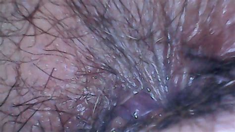 Hot Vore Hairy Endoscopy Exploration 4K Nicoletta Embassi Clips4Sale