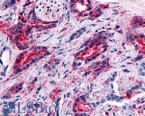 PathPlus GPR89A Polyclonal Antibody Rabbit Anti Human IHC LSBio