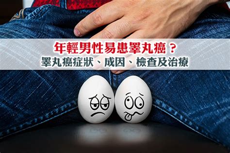 【睪丸癌】年輕男性易中招？睪丸癌症狀、成因、檢查及治療 Esdlife健康網購