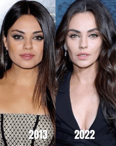 Mila Kunis Plastic Surgery: Then & Now | PlasticSurgeryInsights.com