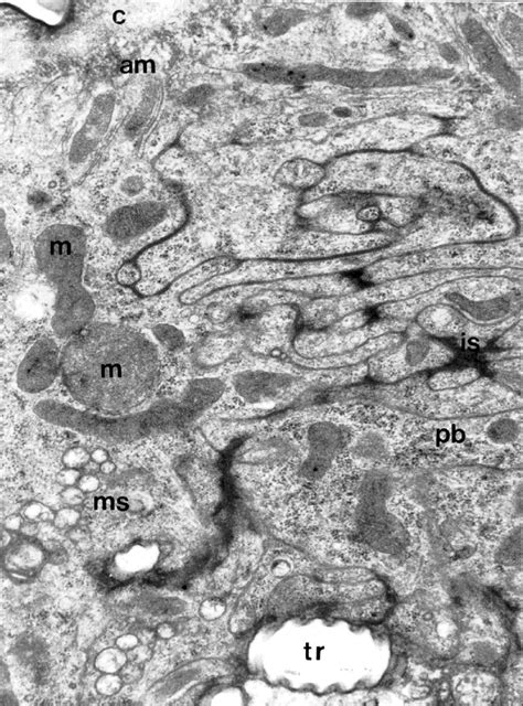 Magni Cation Of The Apical Surface Showing Some Subcuticular Download Scientific Diagram