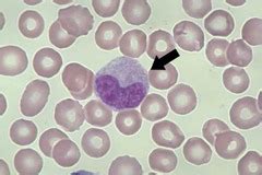 WBC Morphology Flashcards | Quizlet
