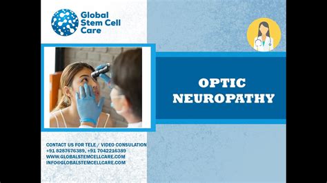 Stem Cell Treatment For Optic Neuropathy Best Treatment For Optic