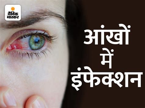 Eye Discharge Redness Blockage In The Tear Duct May Be The Reason नींद से जागते ही क्यों