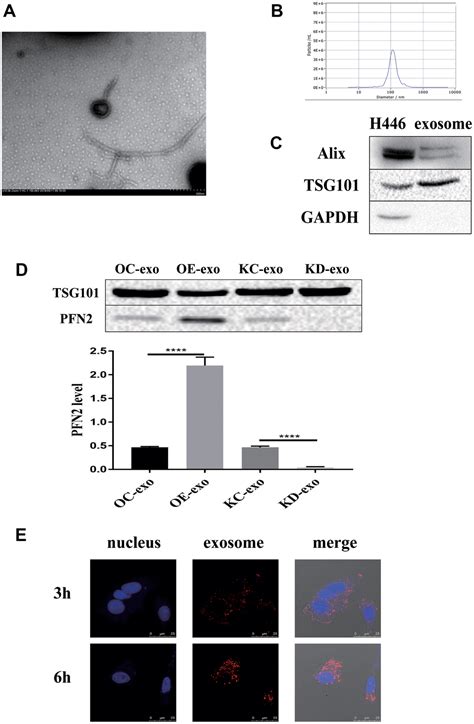 Profilin 2 Promotes Growth Metastasis And Angiogenesis Of Small Cell