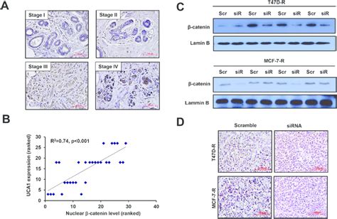 Correlation Of The Expression Of Lncrna Uca1 And The Nuclear β Catenin Download Scientific