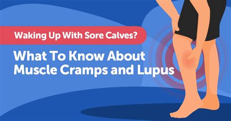 Waking Up With Sore Calves What To Know About Muscle Cramps And Lupus Mylupusteam