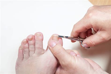 How To Prevent Ingrown Toenails Vargas Foot Specialists