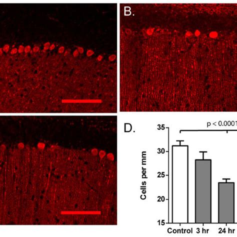 Histological Analysis Of CA1 Region Of The Hippocampus Demonstrates