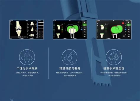 从置换到“智”换！河南省级医院首例上市国产机器人辅助下全膝人工关节置换手术成功完成 大河网