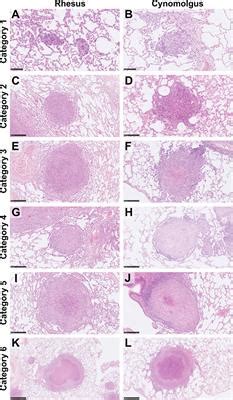 Frontiers Dynamics Of Macrophage T And B Cell Infiltration Within