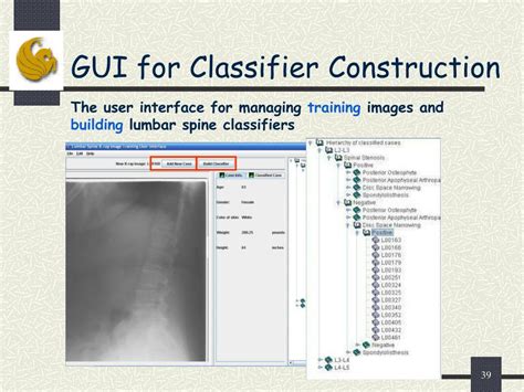 Ppt Computer Aided Diagnosis System For Lumbar Spinal Stenosis Using X Ray Images Powerpoint