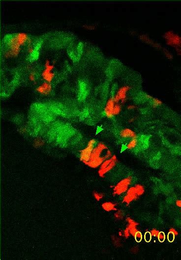 Live Imaging Of Heart Tube Development In Mouse Reveals Alternating