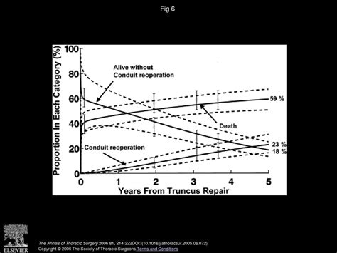 Truncus Arteriosus Associated With Interrupted Aortic Arch In 50