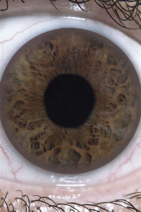 Ocular Prosthesis | Semantic Scholar