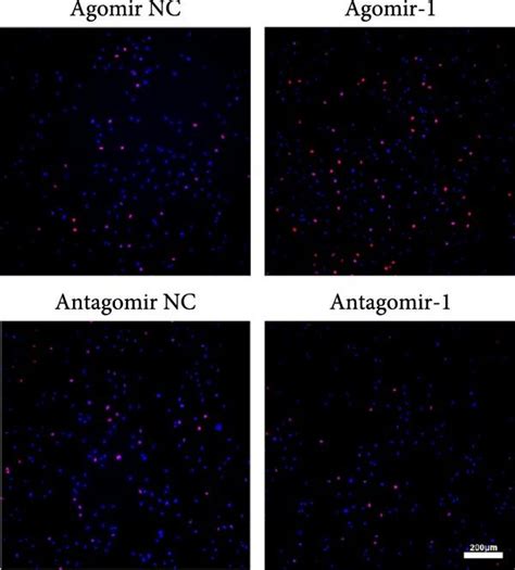 MiR 1 Played An Essential Role In Regulating Chondrocyte Functions A