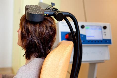 Theta Burst Stimulation Theta Therapy Tms Therapy