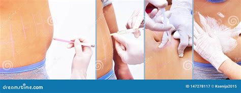 Myostimulation Cosmetologia Do Hardware Cuidado Do Corpo Esculpir N O