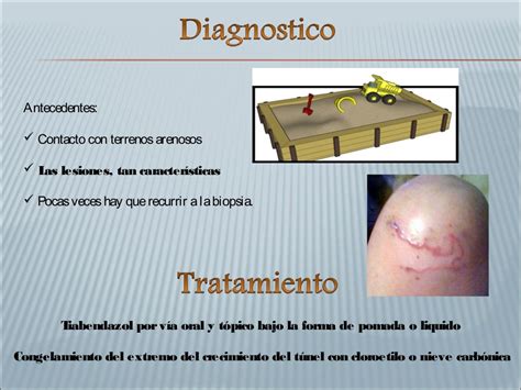 Anquilostomiasis Y Larva Migrans Cutánea