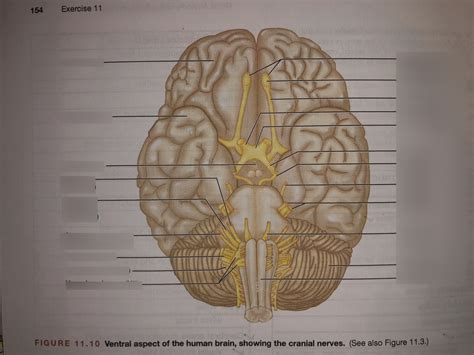 Ventral Aspect Of Brain And Cranial Nerves Diagram Quizlet