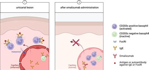 Frontiers The Potential Role Of Basophils In Urticaria