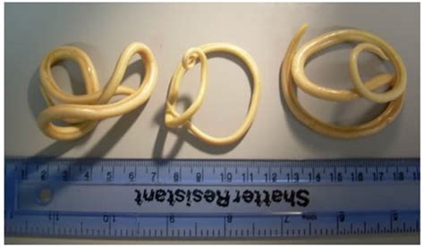 Study Published On The Transmission Of The Giant Roundworm Ascaris