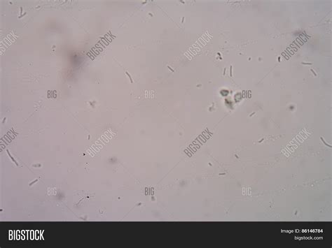 Bacteria Urine Human Image And Photo Free Trial Bigstock