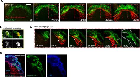 Live Imaging Of Heart Tube Development In Mouse Reveals Alternating