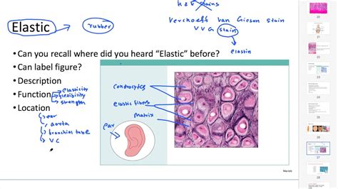 Finite Define companion elastic cartilage labeled Stop by to know ...