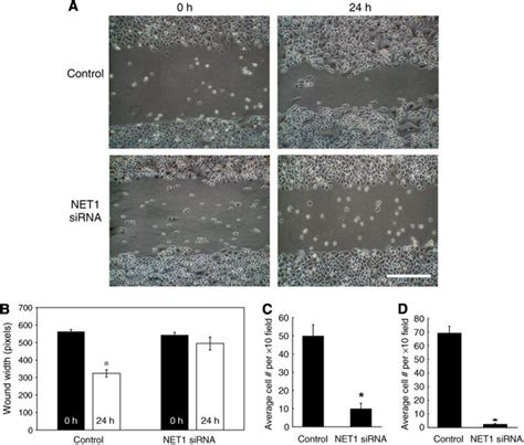 Knockdown Of Net Mrna Expression Results In Decreased Ags Cell