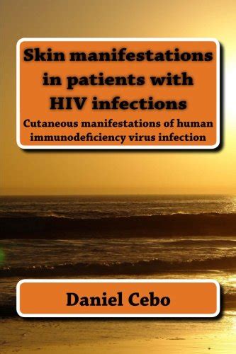 Buy Skin Manifestations In Patients With Hiv Infections Cutaneous