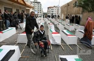 Media dis&dat: Amputees in Gaza face long wait for prosthetics