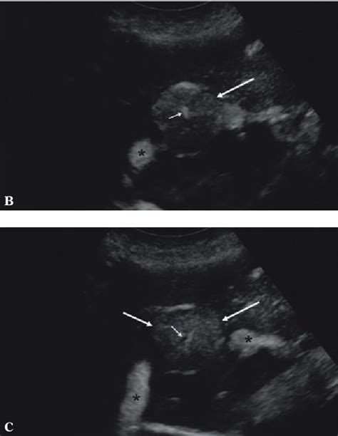 Figure From Diagnostyka Ultrasonograficzna Z Zastosowaniem Do Ylnych