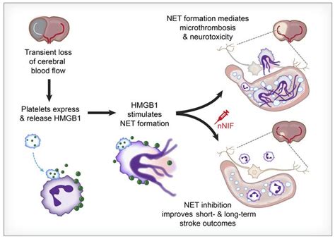 Jci Neutrophil Extracellular Traps Regulate Ischemic Stroke Brain Injury