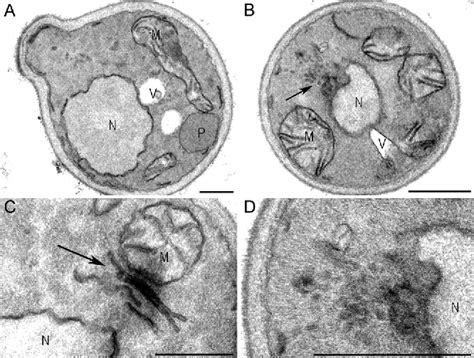 Figure From Peroxisome Reintroduction In Hansenula Polymorpha