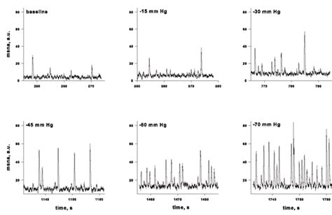 Muscle Sympathetic Nerve Activity Msna In A Representative Subject