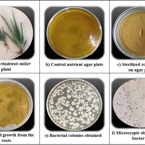 Isolation Of Endophytic Bacteria From The Fresh Roots Of A Barbadensis