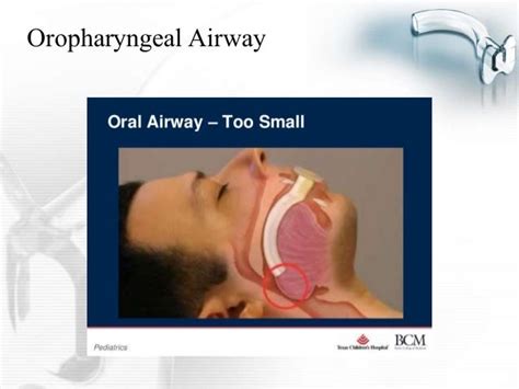 Oral Airway Presentation