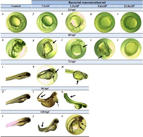 Developmental Abnormalities Observed In Zebrafish D Rerio During